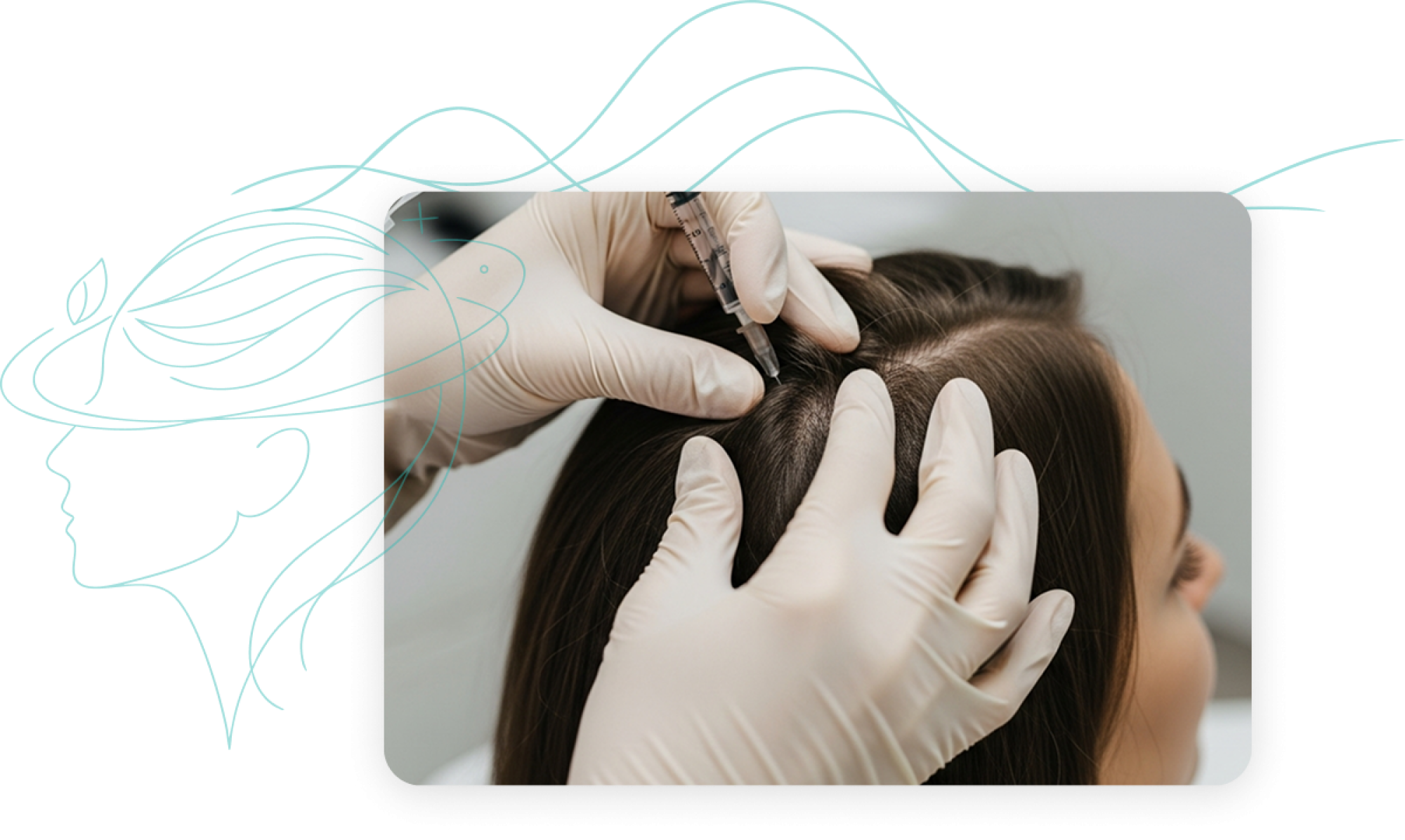 Tricologista e Tratamento de Queda de Cabelo