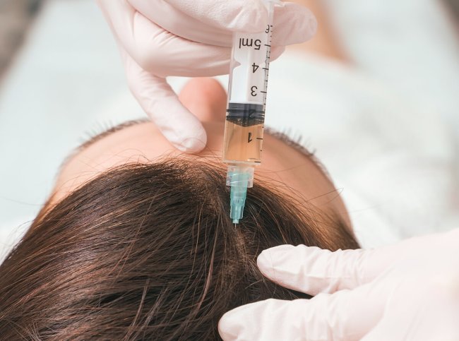 terapias-injetaveis-cabelo-tratamento-capilar-queda-alopecia